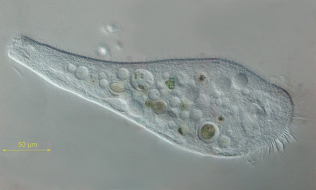 ciliates under microscope