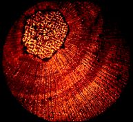Section of pine twig in polarised light
