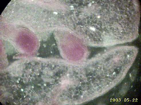 pOPPY OVARY 400X DARK GROUND