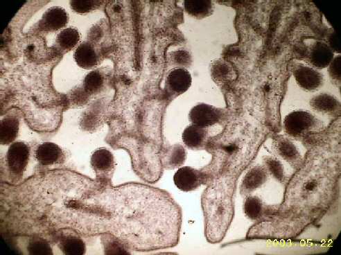 pOPPY OVARY 40X