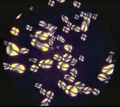 Potato starch in polarised light